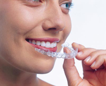 Invisalign - Schiene zur unsichtbaren Zahnkorrektur